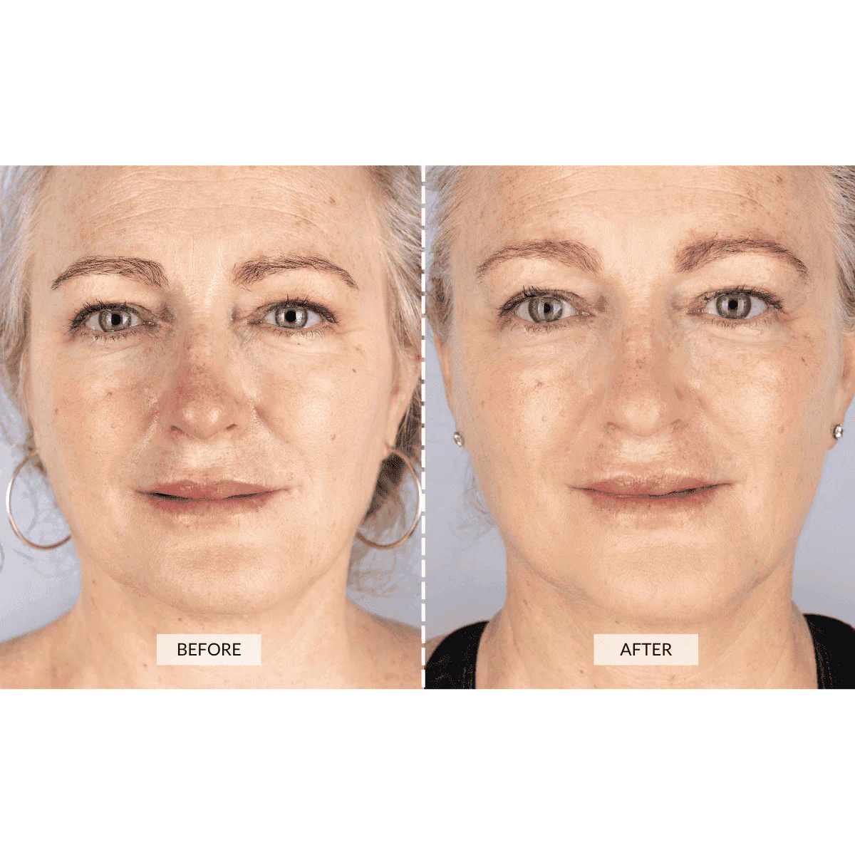 Currentbody - RETURNS - CurrentBody Skin Face & Neck Kit - Image 7