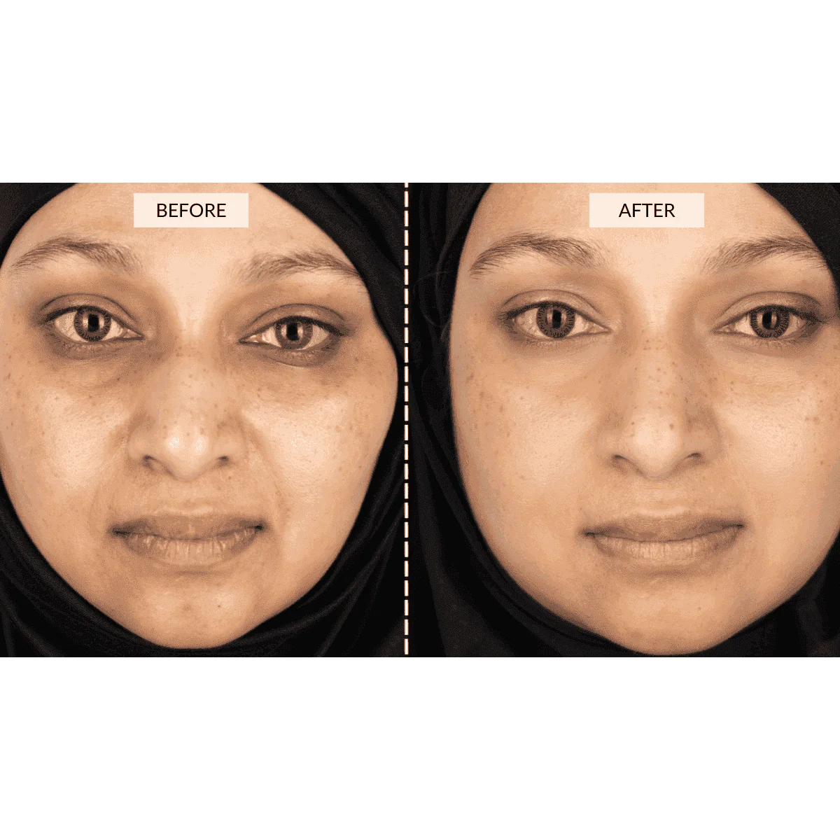 Currentbody - RETURNS - CurrentBody Skin Face & Neck Kit - Image 8